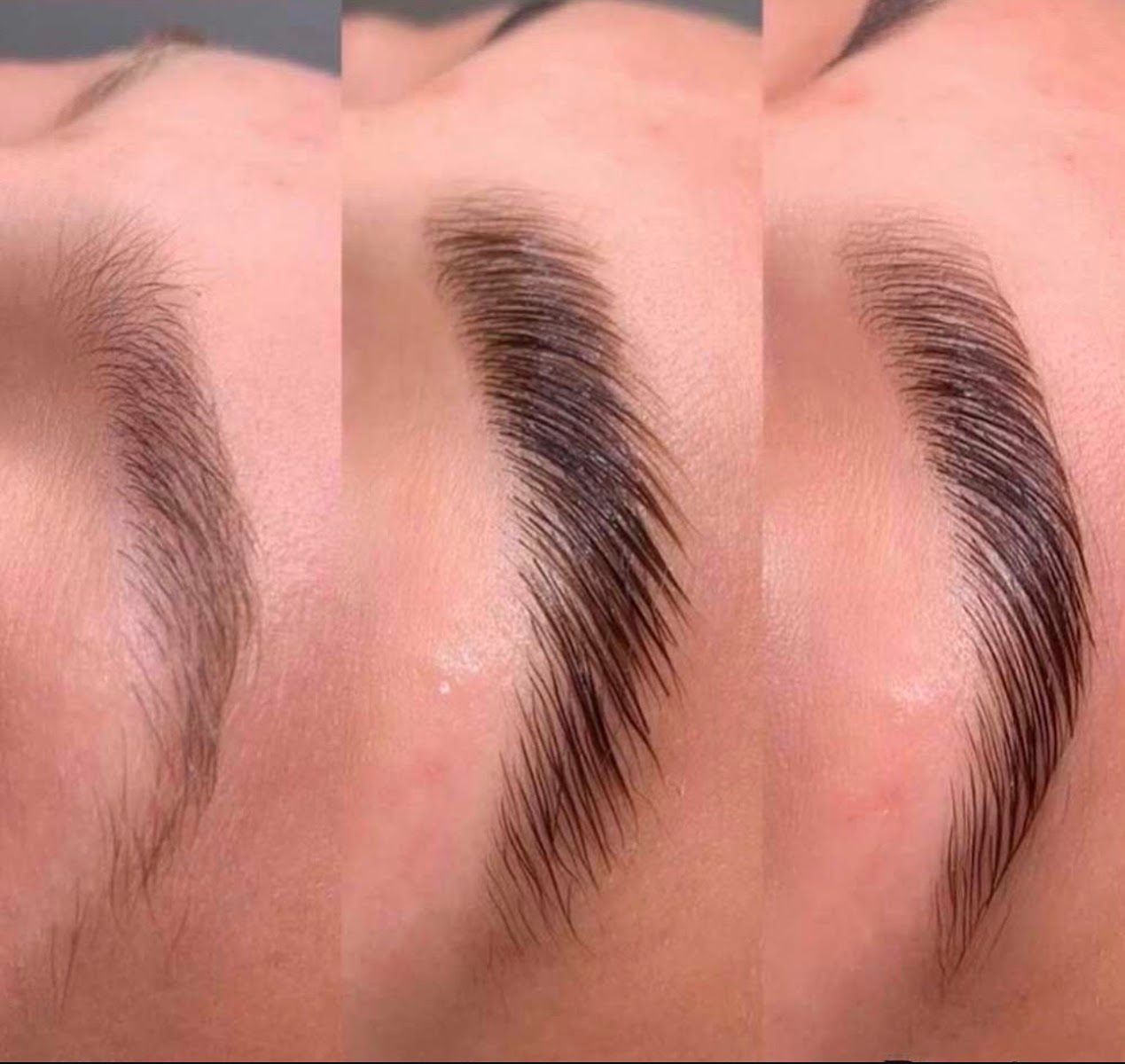 Brow transformation